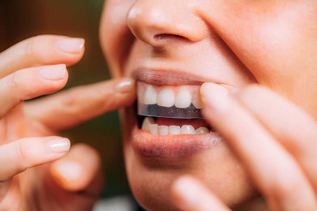 The Rise of At‑Home Aligners and Whitening: Navigating DIY Dentistry in Your Op