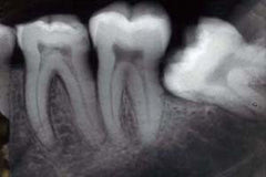 Radiation and Radiography Safety: FDA Guidelines - 3 CEs